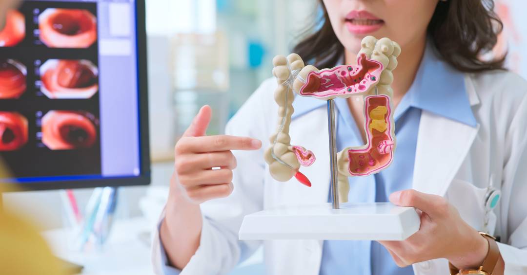 pesquisadores-da-usp-identificam-exame-que-preve-risco-de-metastase-no-cancer-de-reto