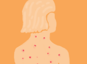 o-que-levou-a-regiao-das-americas-a-perder-o-certificado-de-eliminacao-do-sarampo